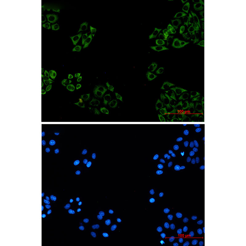 FXR1 Rabbit mAb
